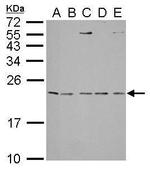 IL1RA Antibody in Western Blot (WB)