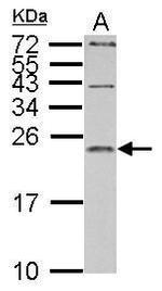 IL1RA Antibody in Western Blot (WB)