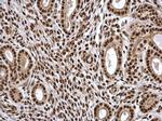 PSME3 Antibody in Immunohistochemistry (Paraffin) (IHC (P))