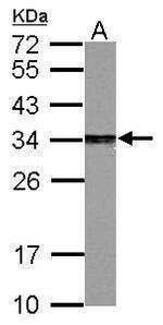 PSME3 Antibody in Western Blot (WB)