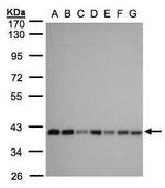 SLC25A33 Antibody in Western Blot (WB)