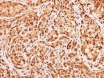 MID1IP1 Antibody in Immunohistochemistry (Paraffin) (IHC (P))