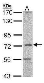 DNAI2 Antibody in Western Blot (WB)