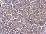 PHLP Antibody in Immunohistochemistry (Paraffin) (IHC (P))