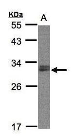 NSMCE1 Antibody in Western Blot (WB)