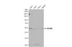 NSUN6 Antibody in Western Blot (WB)