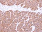 VTA1 Antibody in Immunohistochemistry (Paraffin) (IHC (P))