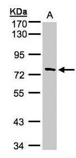 TTC30A Antibody in Western Blot (WB)