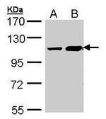 TRAK2 Antibody in Western Blot (WB)