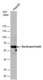 NUP62 Antibody in Western Blot (WB)