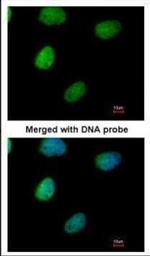 ITPK1 Antibody in Immunocytochemistry (ICC/IF)