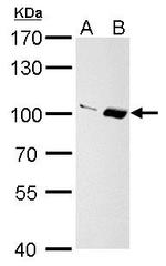 Importin 13 Antibody in Western Blot (WB)