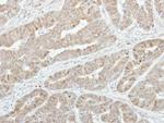 GSTA1 Antibody in Immunohistochemistry (Paraffin) (IHC (P))