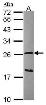 GSTA1 Antibody in Western Blot (WB)