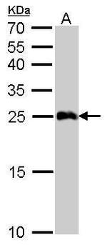 GSTA1 Antibody in Western Blot (WB)