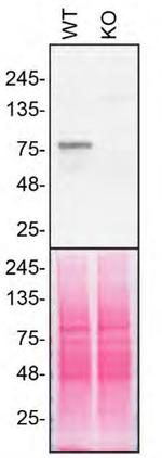 VPS35 Antibody in Western Blot (WB)