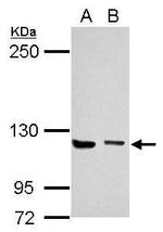 Munc13-4 Antibody in Western Blot (WB)