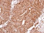 HRH2 Antibody in Immunohistochemistry (Paraffin) (IHC (P))