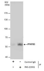 PFKFB3 Antibody in Immunoprecipitation (IP)