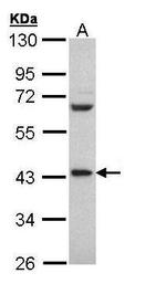 PCBP2 Antibody in Western Blot (WB)