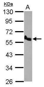 BMP-10 Antibody in Western Blot (WB)