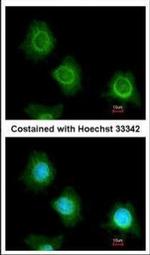 PF4V1 Antibody in Immunocytochemistry (ICC/IF)