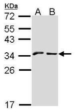 NKG2A Antibody in Western Blot (WB)