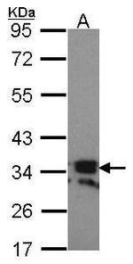 CD254 (RANK Ligand) Antibody in Western Blot (WB)