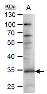 CD254 (RANK Ligand) Antibody in Western Blot (WB)