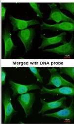 CAMK1D Antibody in Immunocytochemistry (ICC/IF)