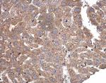 CAMK1D Antibody in Immunohistochemistry (Paraffin) (IHC (P))