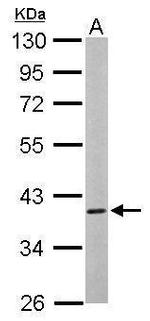 CAMK1D Antibody in Western Blot (WB)