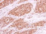 RPA70 Antibody in Immunohistochemistry (Paraffin) (IHC (P))