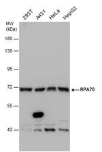 RPA70 Antibody in Western Blot (WB)