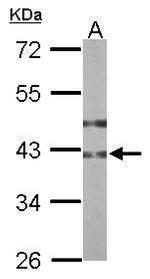 B3GNT3 Antibody in Western Blot (WB)