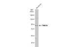 TNNI3K Antibody in Western Blot (WB)