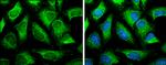 SLC25A13 Antibody in Immunocytochemistry (ICC/IF)