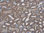 SLC25A13 Antibody in Immunohistochemistry (Paraffin) (IHC (P))