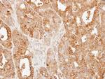 SLC25A13 Antibody in Immunohistochemistry (Paraffin) (IHC (P))