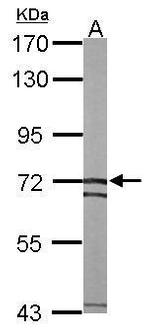 SLC25A13 Antibody in Western Blot (WB)