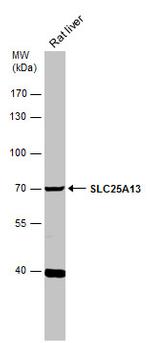 SLC25A13 Antibody in Western Blot (WB)