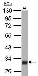 HMGCL Antibody in Western Blot (WB)