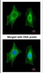 PSPH Antibody in Immunocytochemistry (ICC/IF)