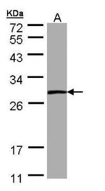 PSPH Antibody in Western Blot (WB)