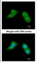 UBE2G2 Antibody in Immunocytochemistry (ICC/IF)