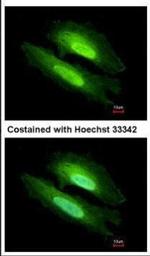 PDE6D Antibody in Immunocytochemistry (ICC/IF)