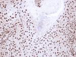 NHP2L1 Antibody in Immunohistochemistry (Paraffin) (IHC (P))