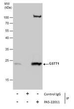 GSTT1 Antibody in Immunoprecipitation (IP)