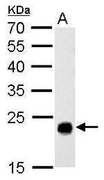 GSTT1 Antibody in Western Blot (WB)