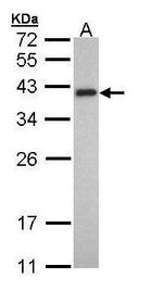 TPM2 Antibody in Western Blot (WB)